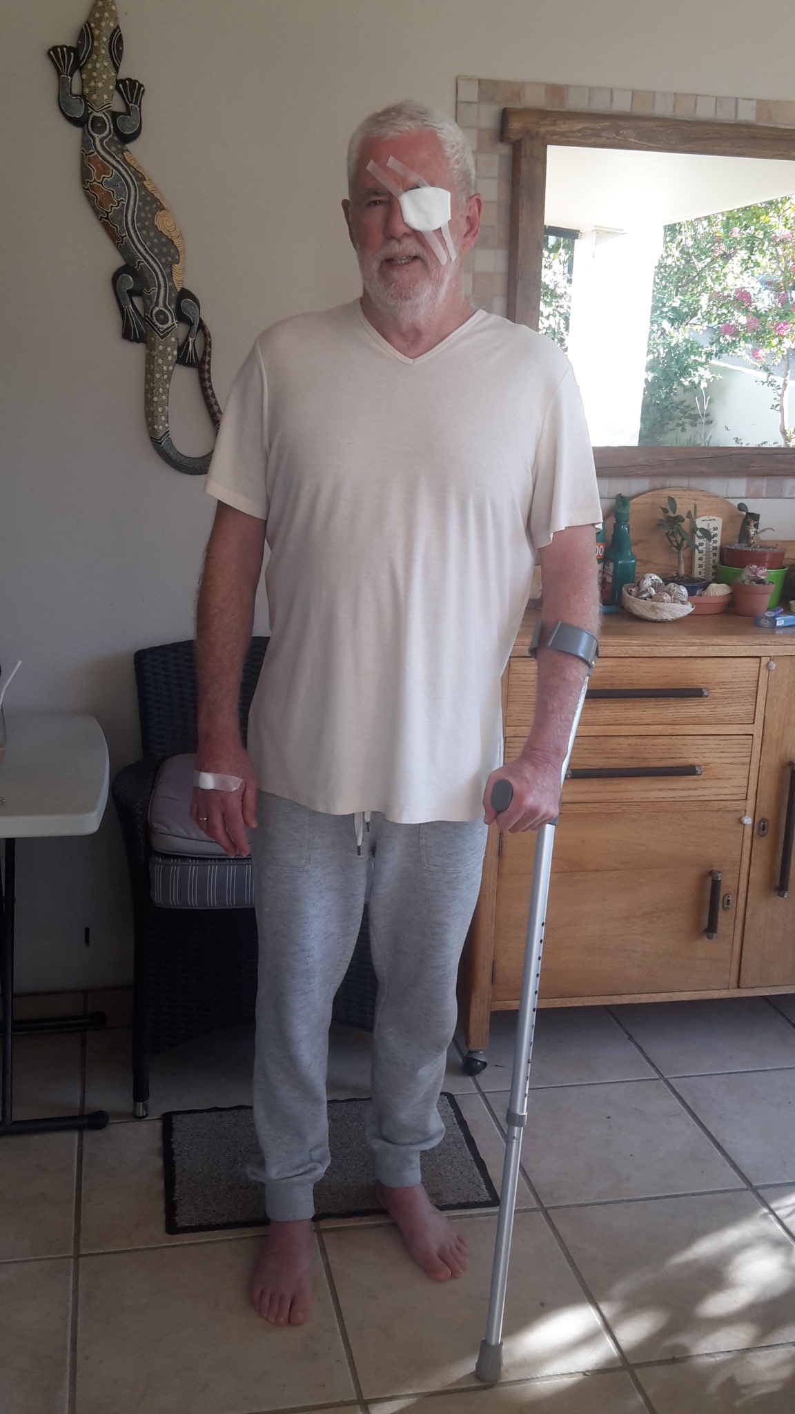 cataract op